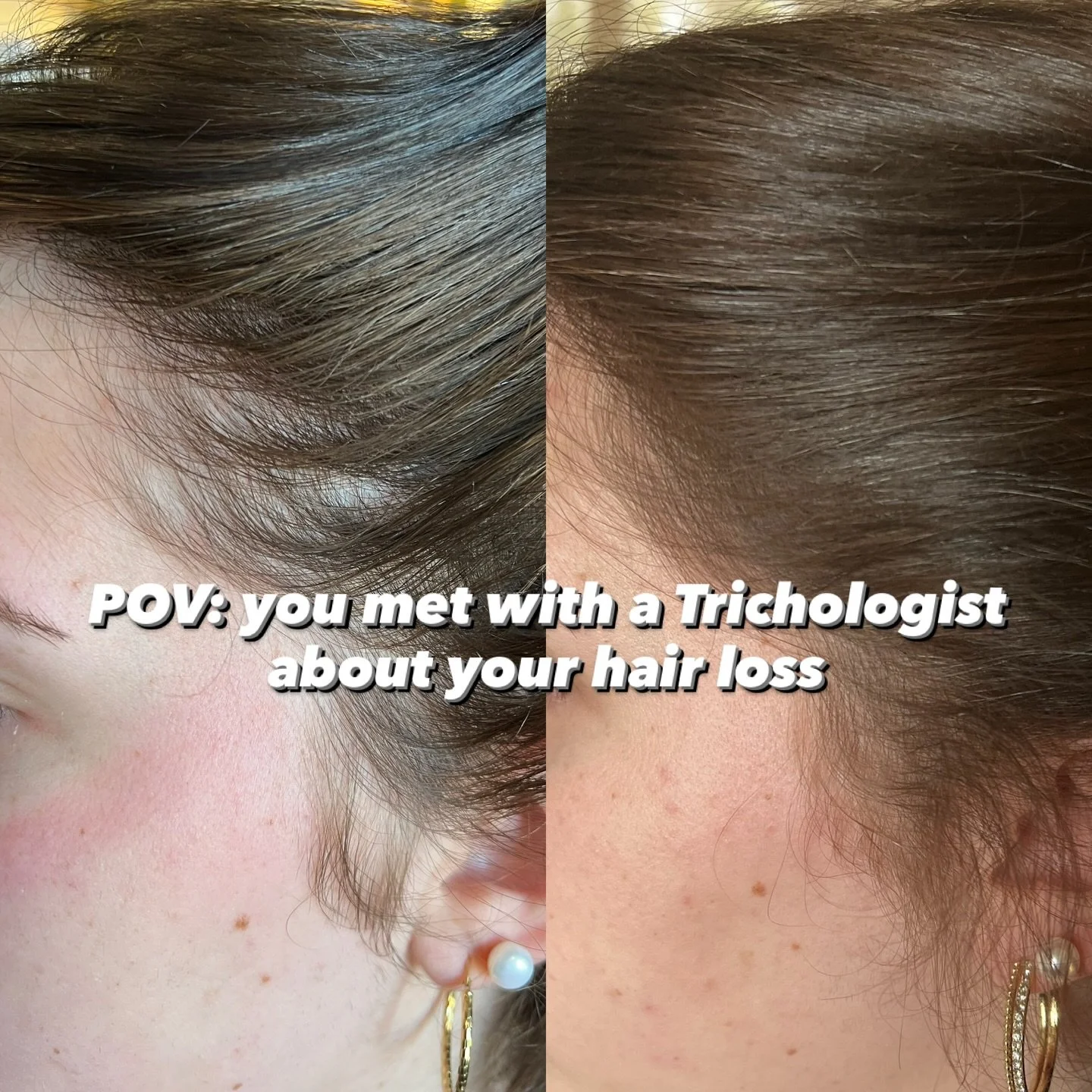 WHAT TO EXPECT WHEN YOU SCHEDULE A HAIR LOSS EVALUATION

Hair loss can feel overwhelming to navigate on your own. And when you&rsquo;re unsure of the cause, choosing the right treatment can feel like shooting in the dark. Without properly tracking yo