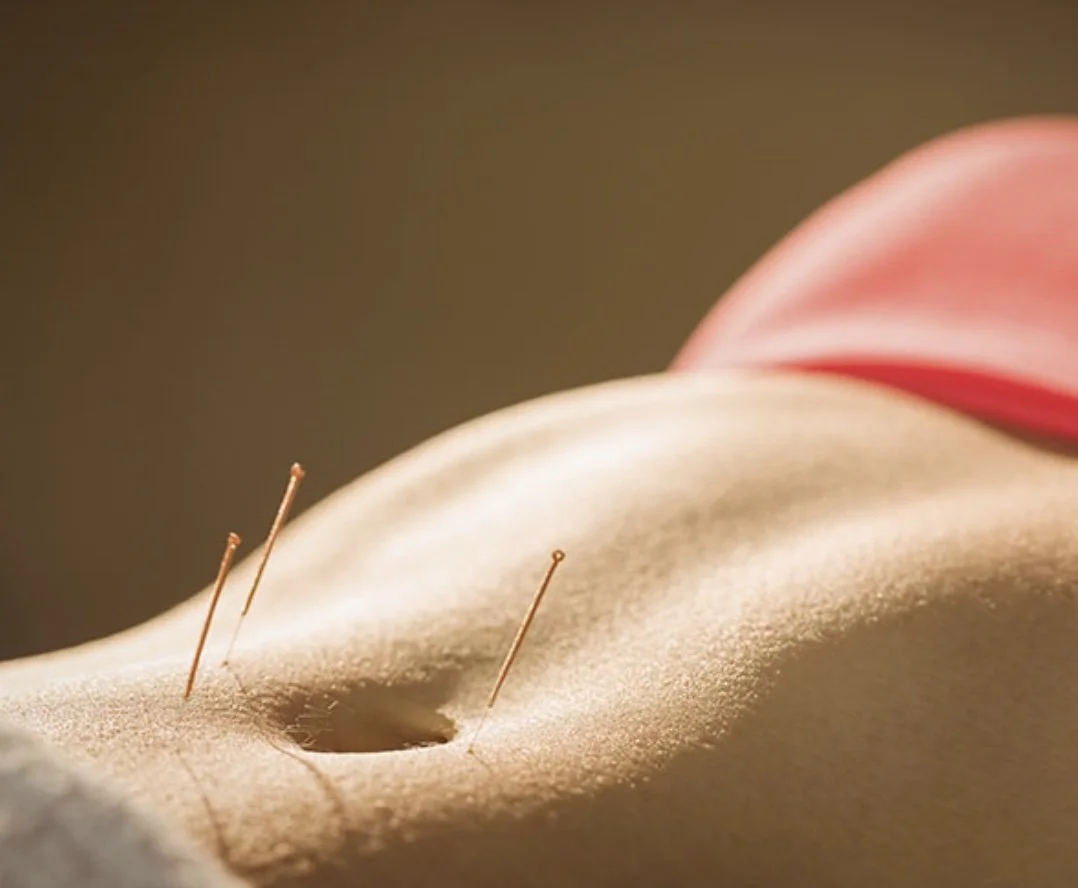Acupuncture &amp; Fertility