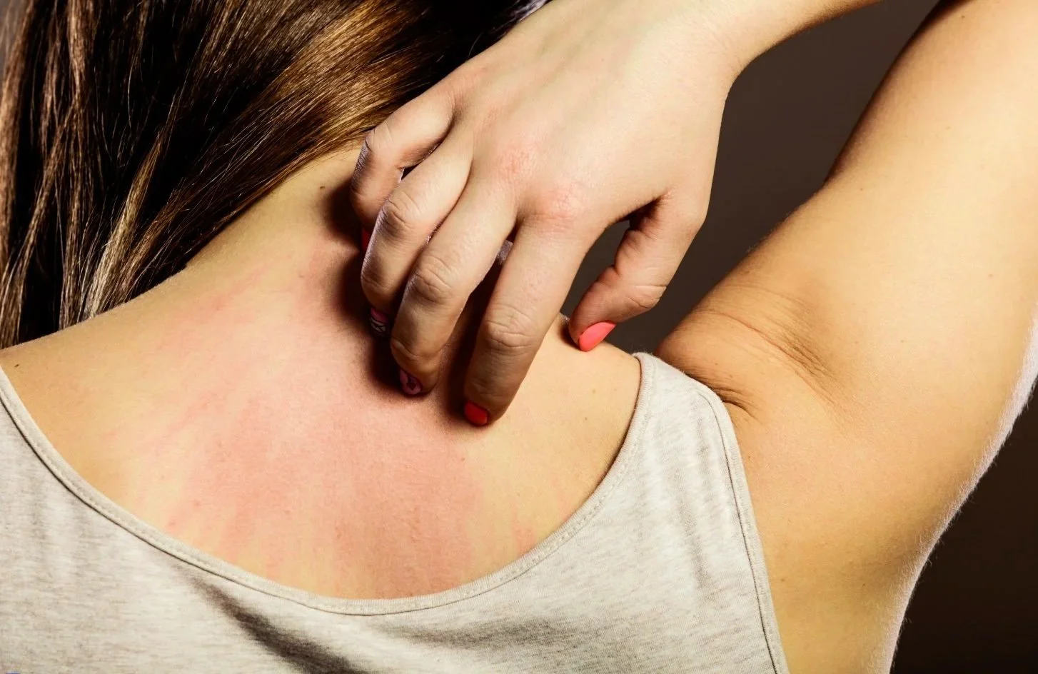 When Your Skin Is Trying to Tell You Something: Chinese Medicine and Autoimmune Skin Conditions