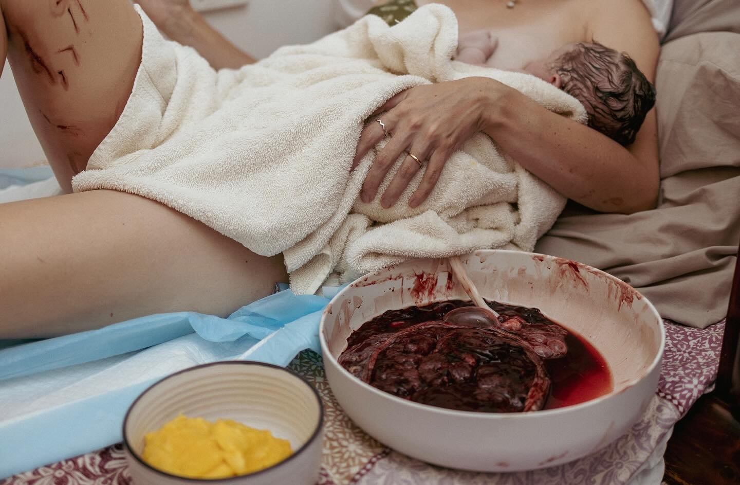 Blood on your legs
Mango by your side
Wet hair in your arms
Placenta by your side

Another day in the life of a Mother
BiRTH
at hOMe

🫶🏻

📸 @wild_and_you @bygeorgiabirthphotography 

Shared with permission 🌸