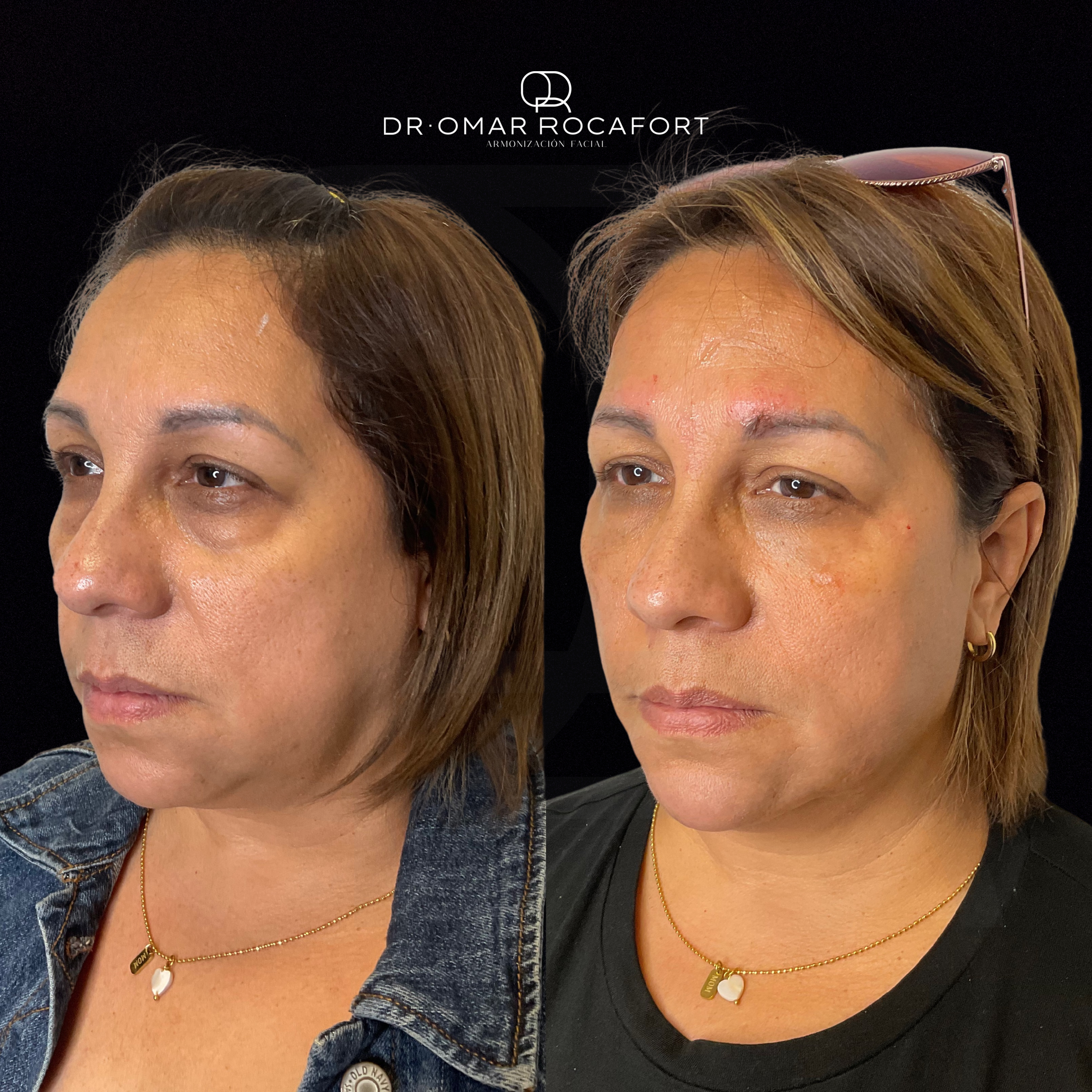 Before and Afters (6).png