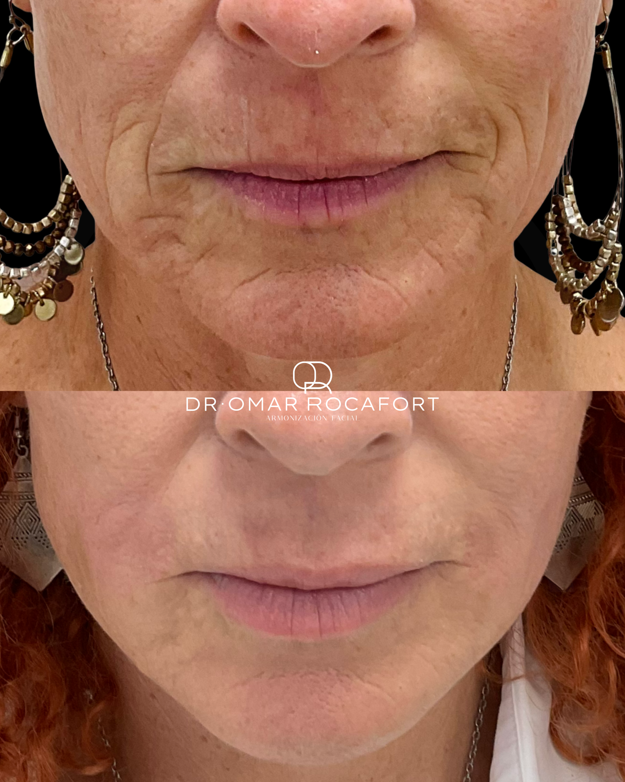 Before and Afters new size - 19.PNG