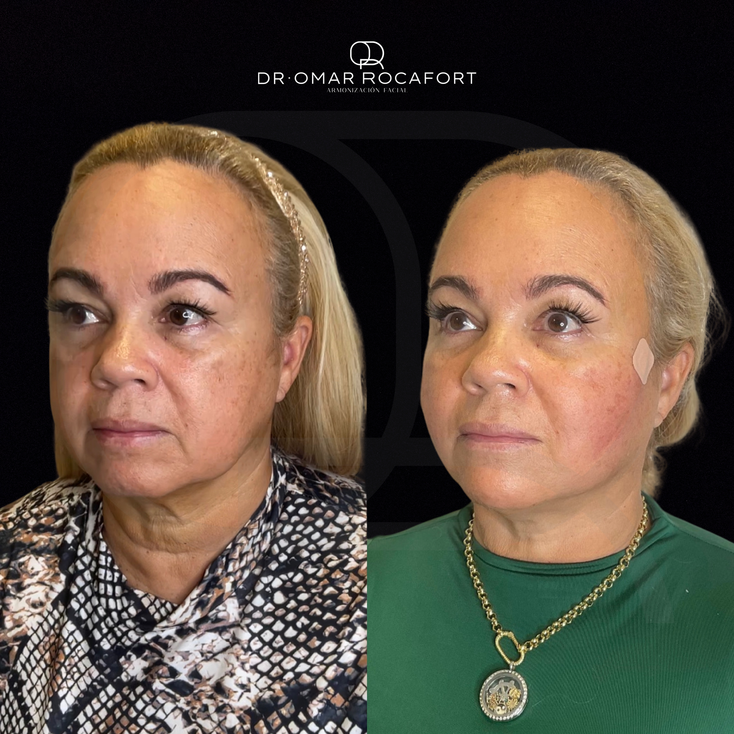 Before and Afters (3).png