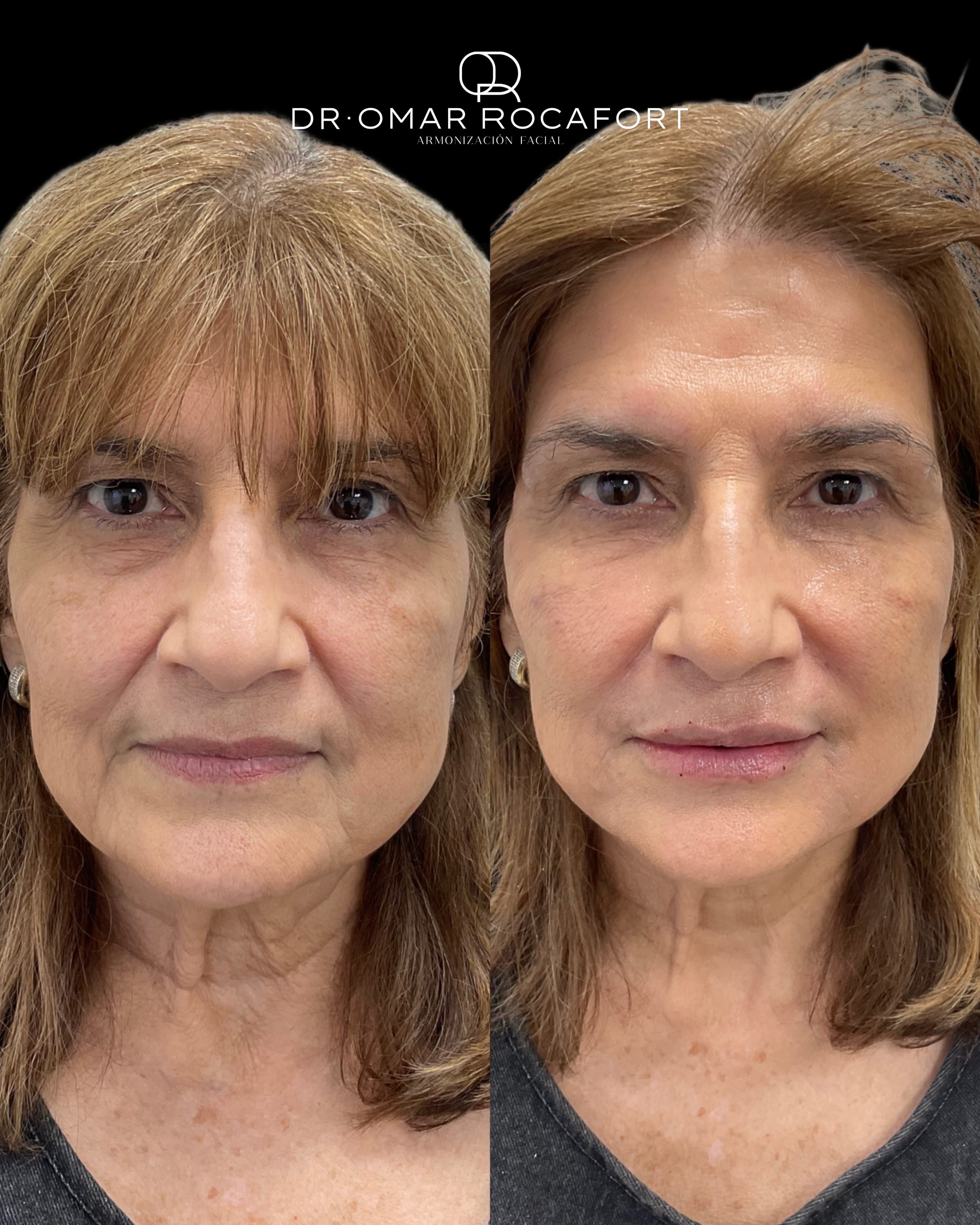 Before and Afters new size - 9.PNG