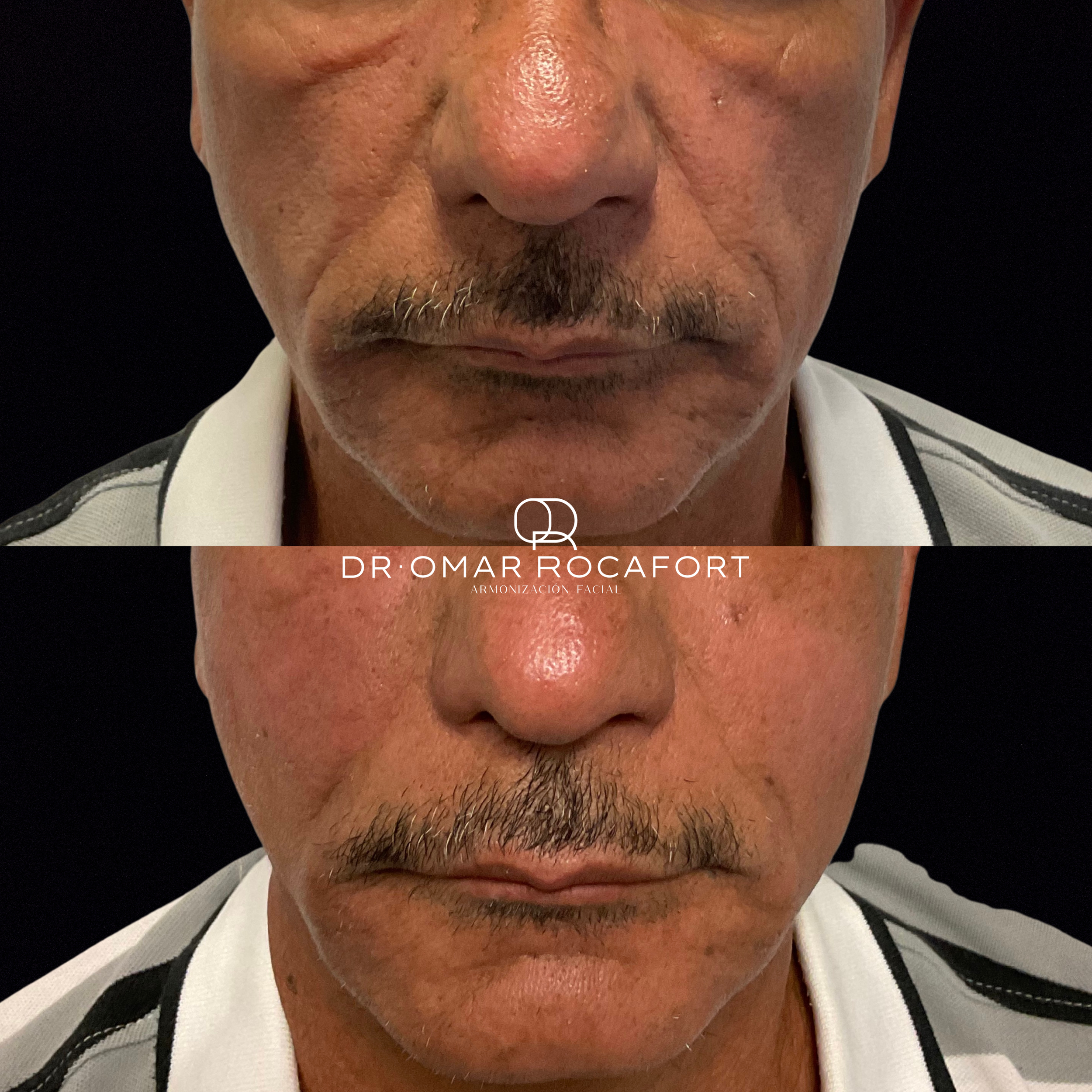 Before and Afters (1).png