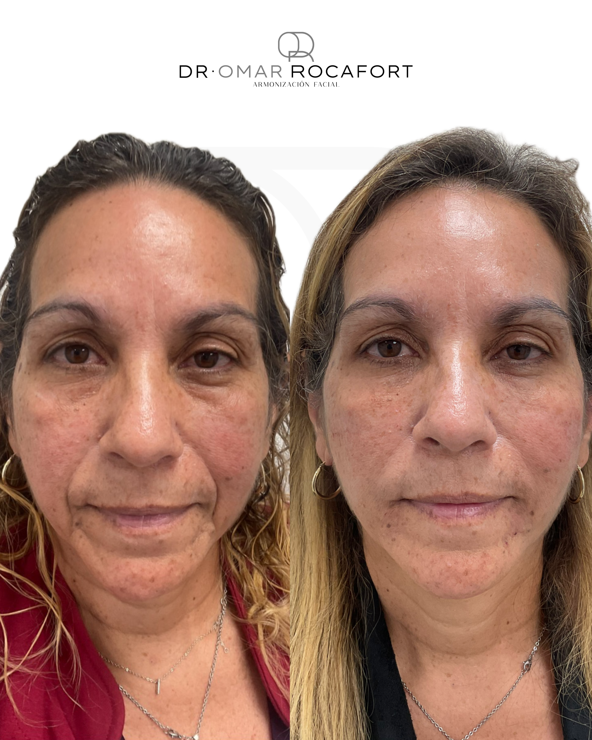 Before and Afters new size - 4.PNG