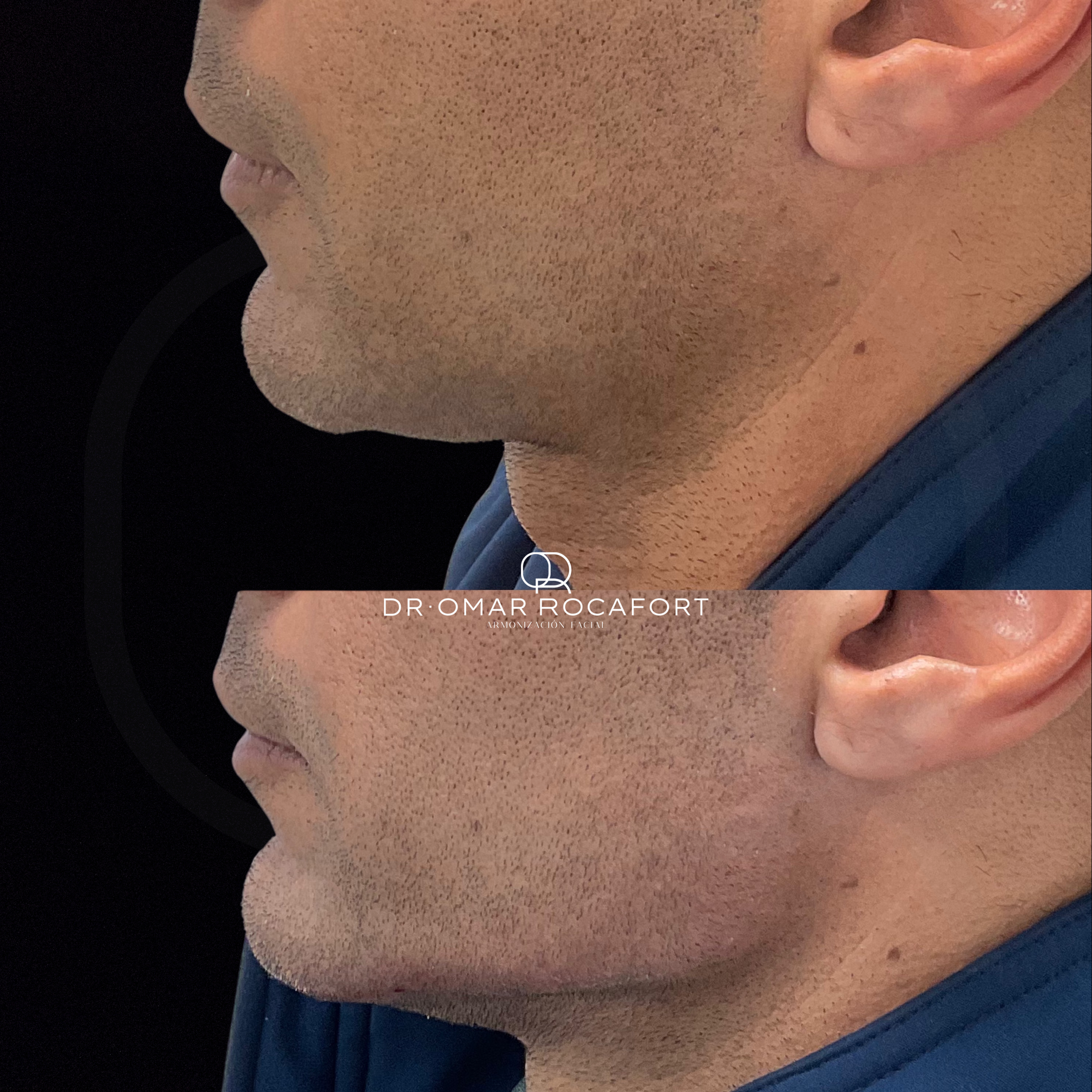 Before and Afters (4).png