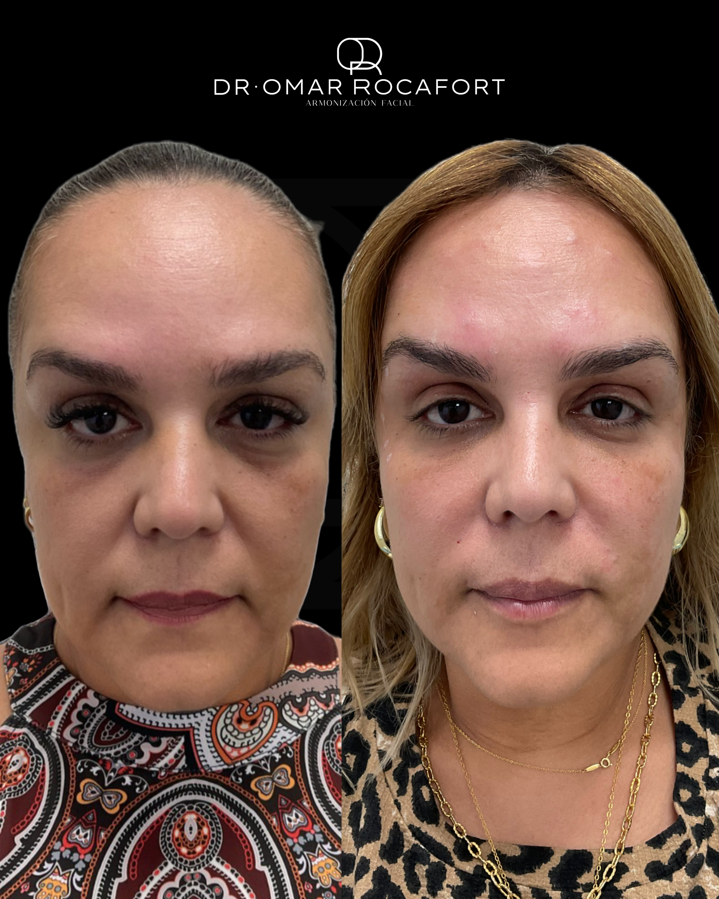 Before and Afters new size - 20.PNG