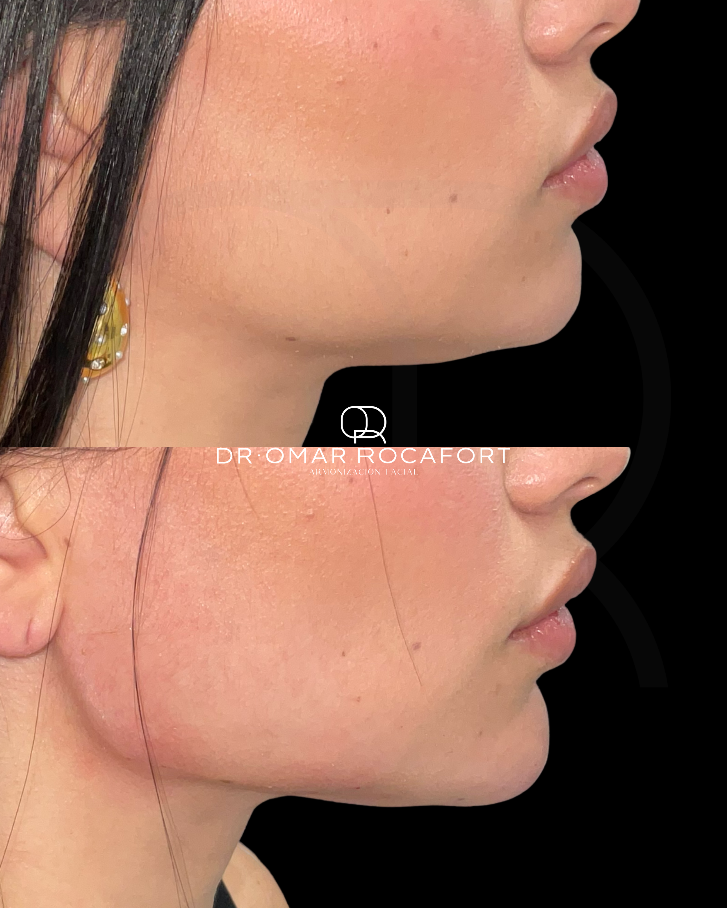 Before and Afters new size - 26.PNG