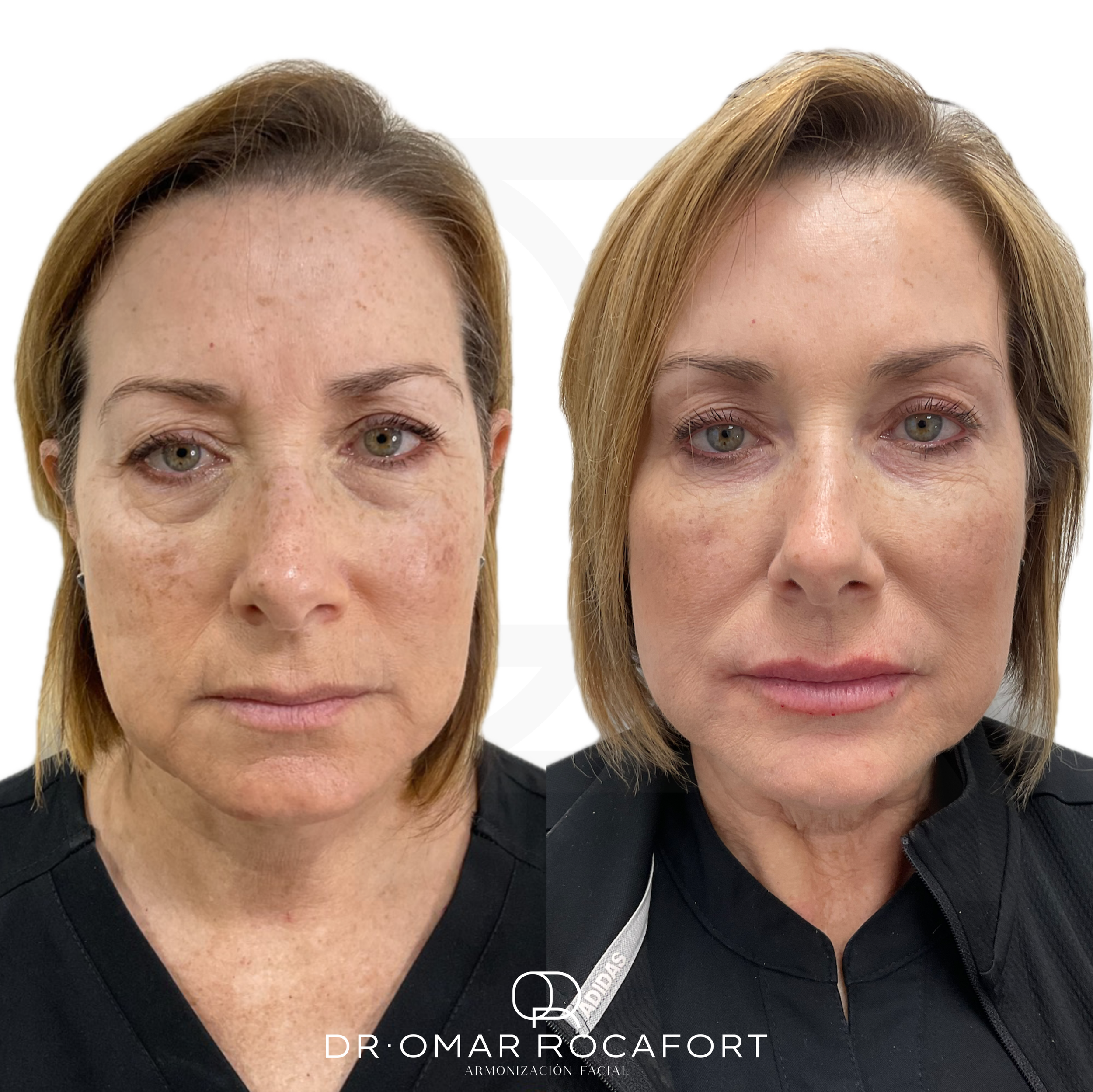 Before and Afters new size - 27.PNG