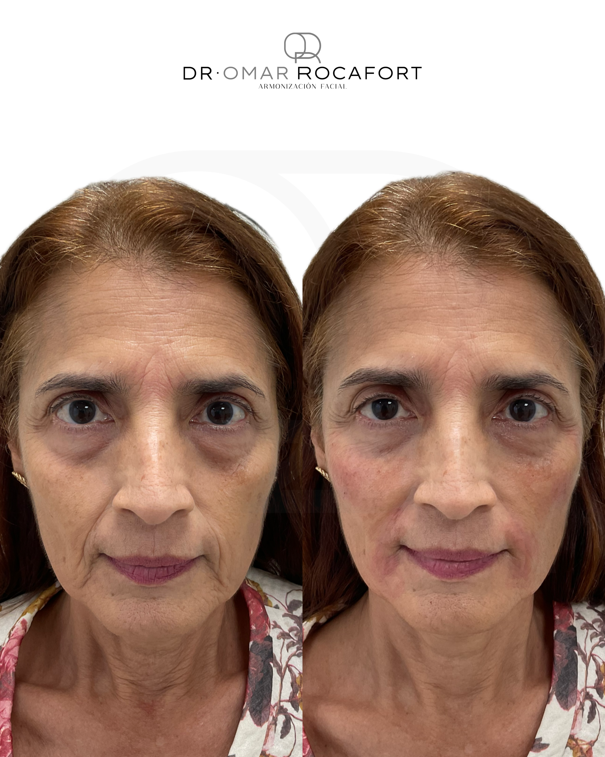 Before and Afters new size - 5.PNG