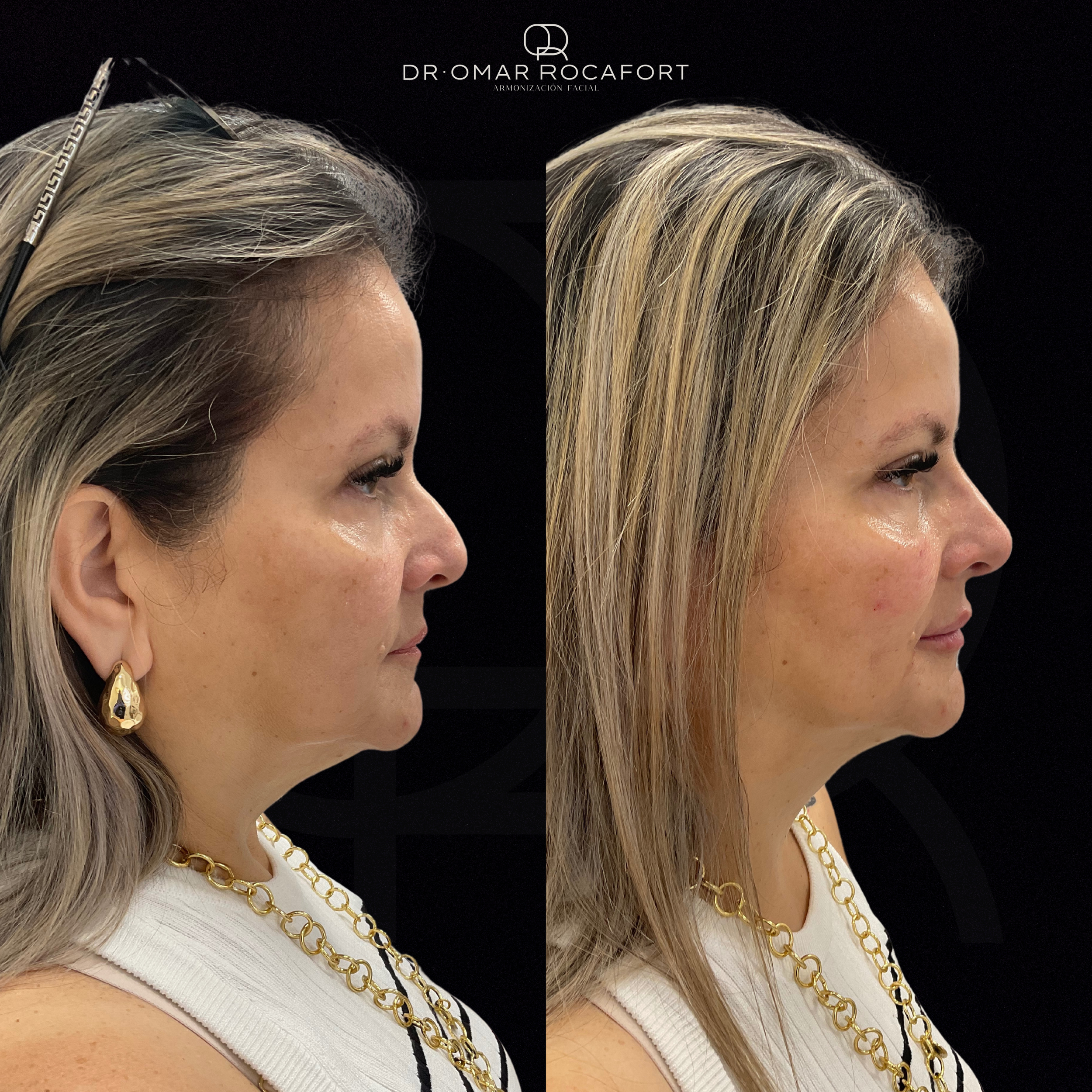 Before and Afters (2).png
