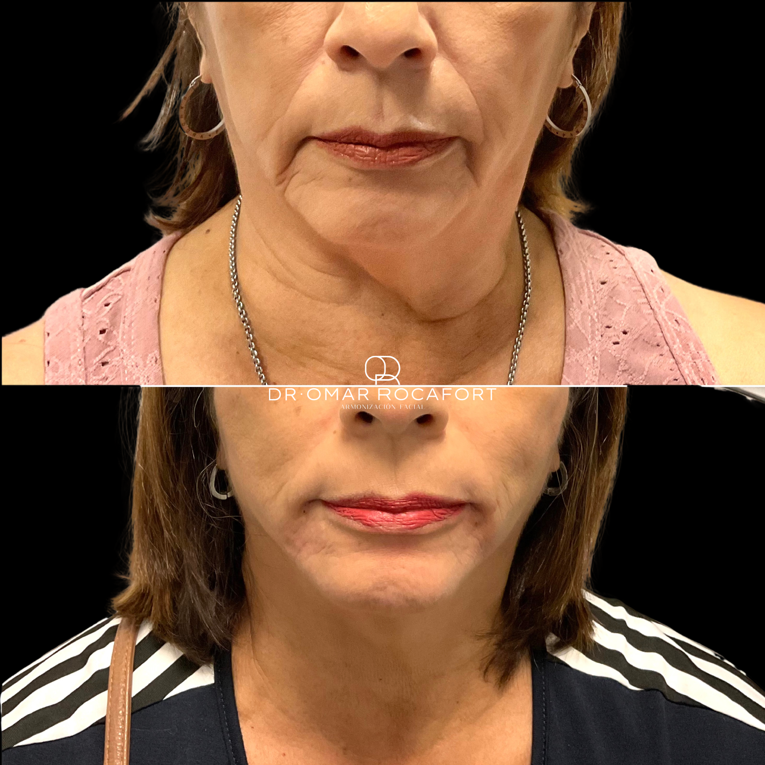 Before and Afters (2).png