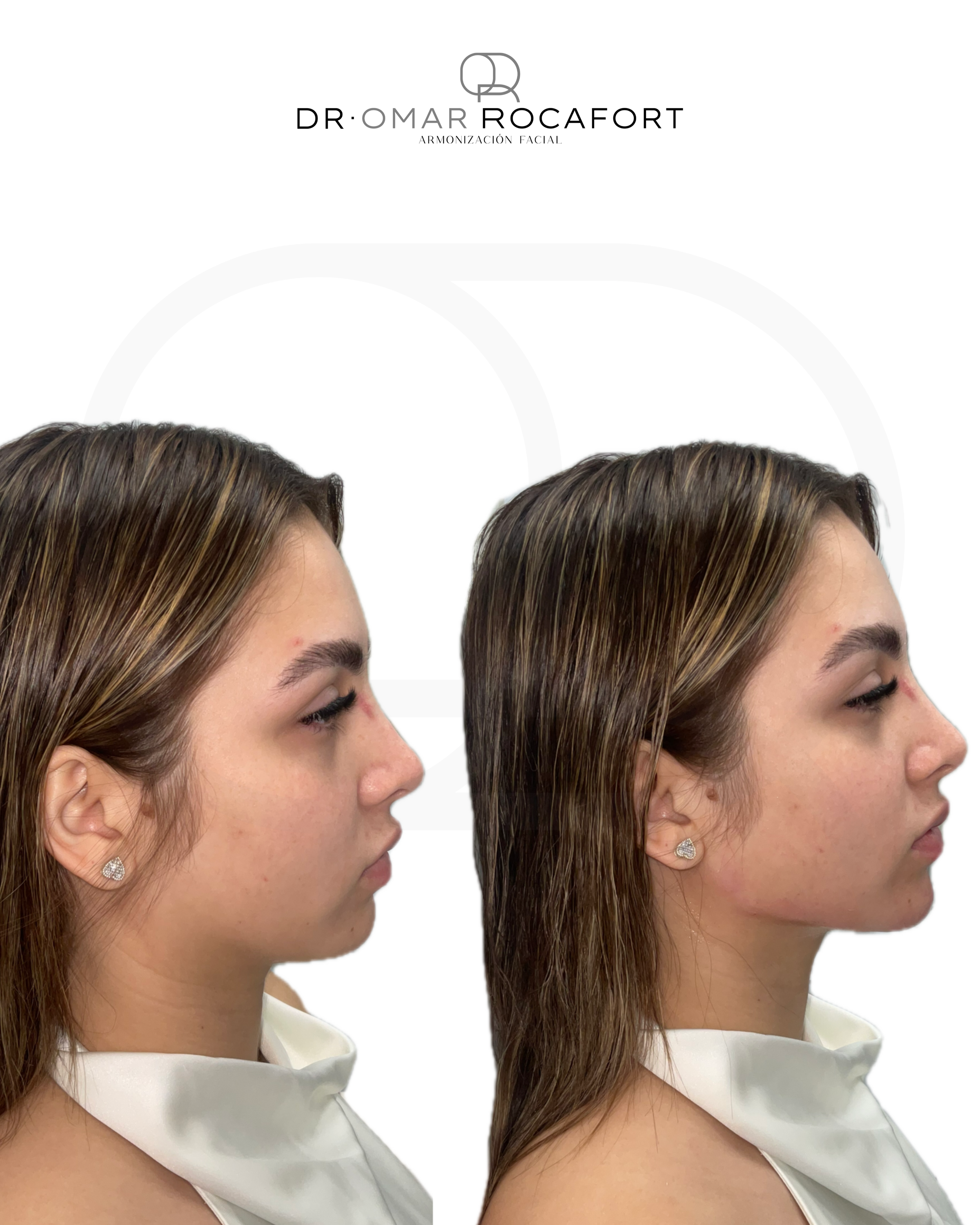 Before and Afters new size - 3.PNG