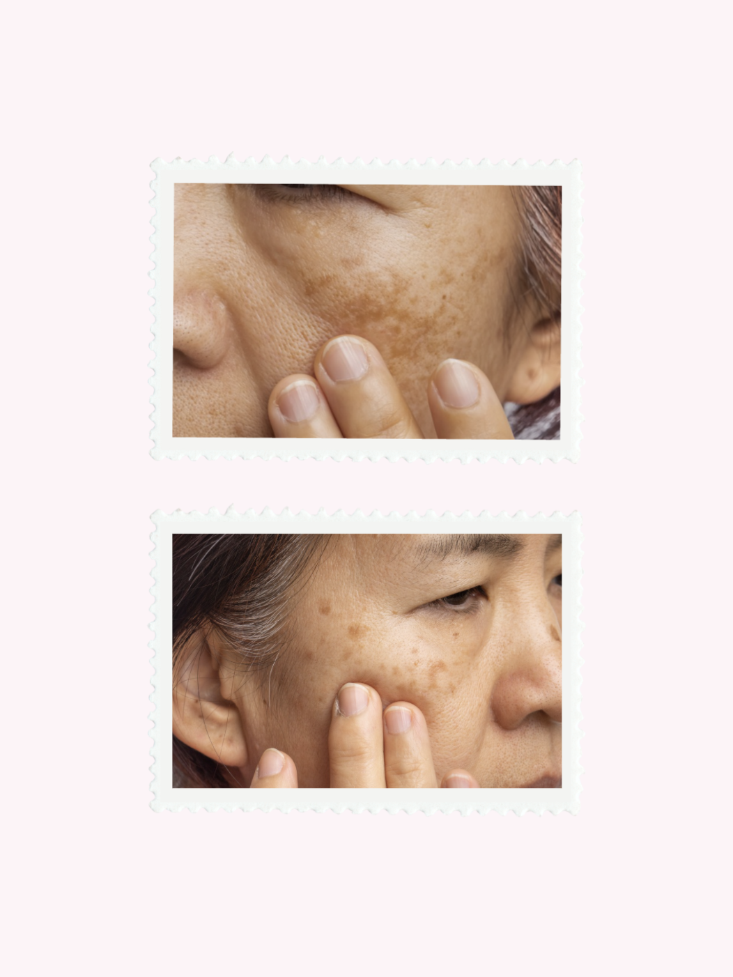 My top 10 products for hyperpigmentation