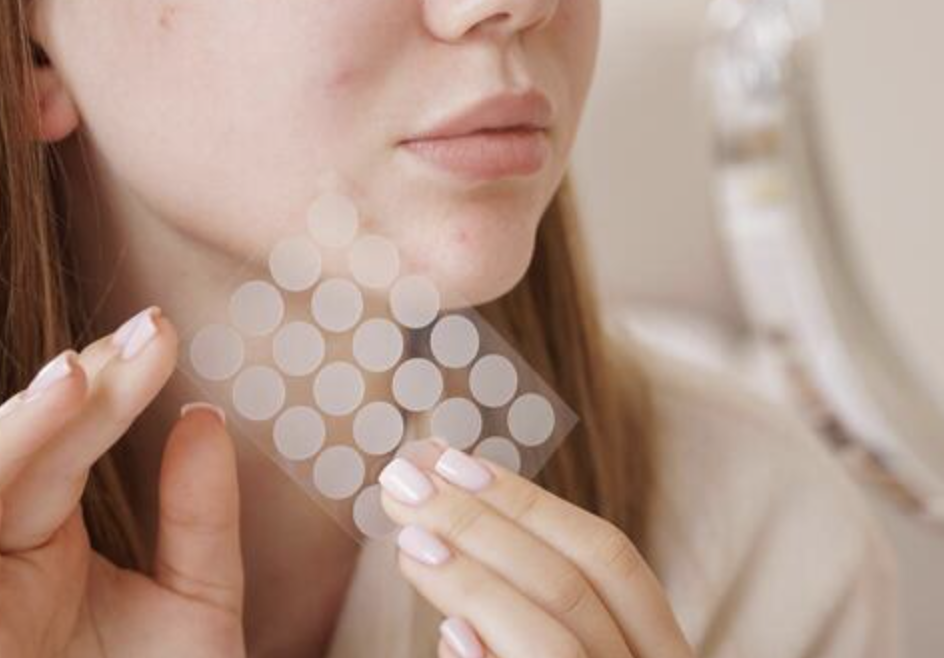You’re probably using pimple patches the wrong way 