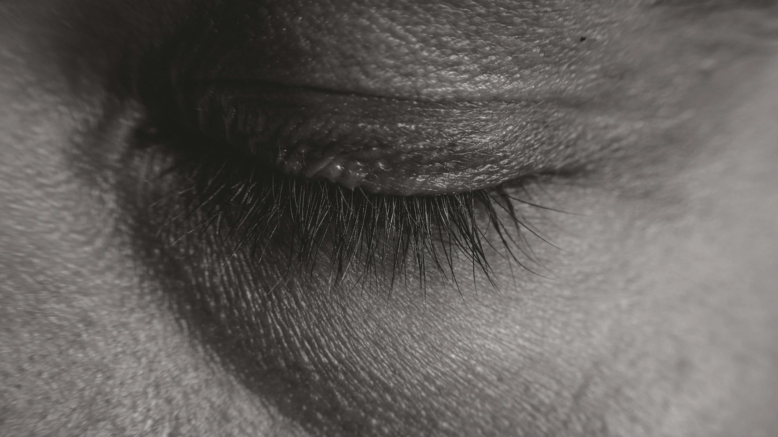 Accelerated Resolution therapy (ART) And trauma