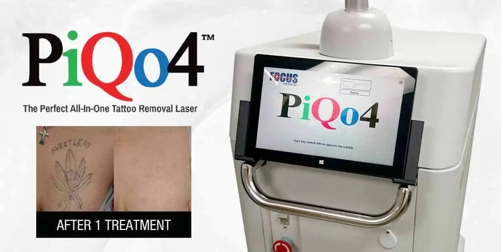 PiQo4 Laser Tattoo Removal System