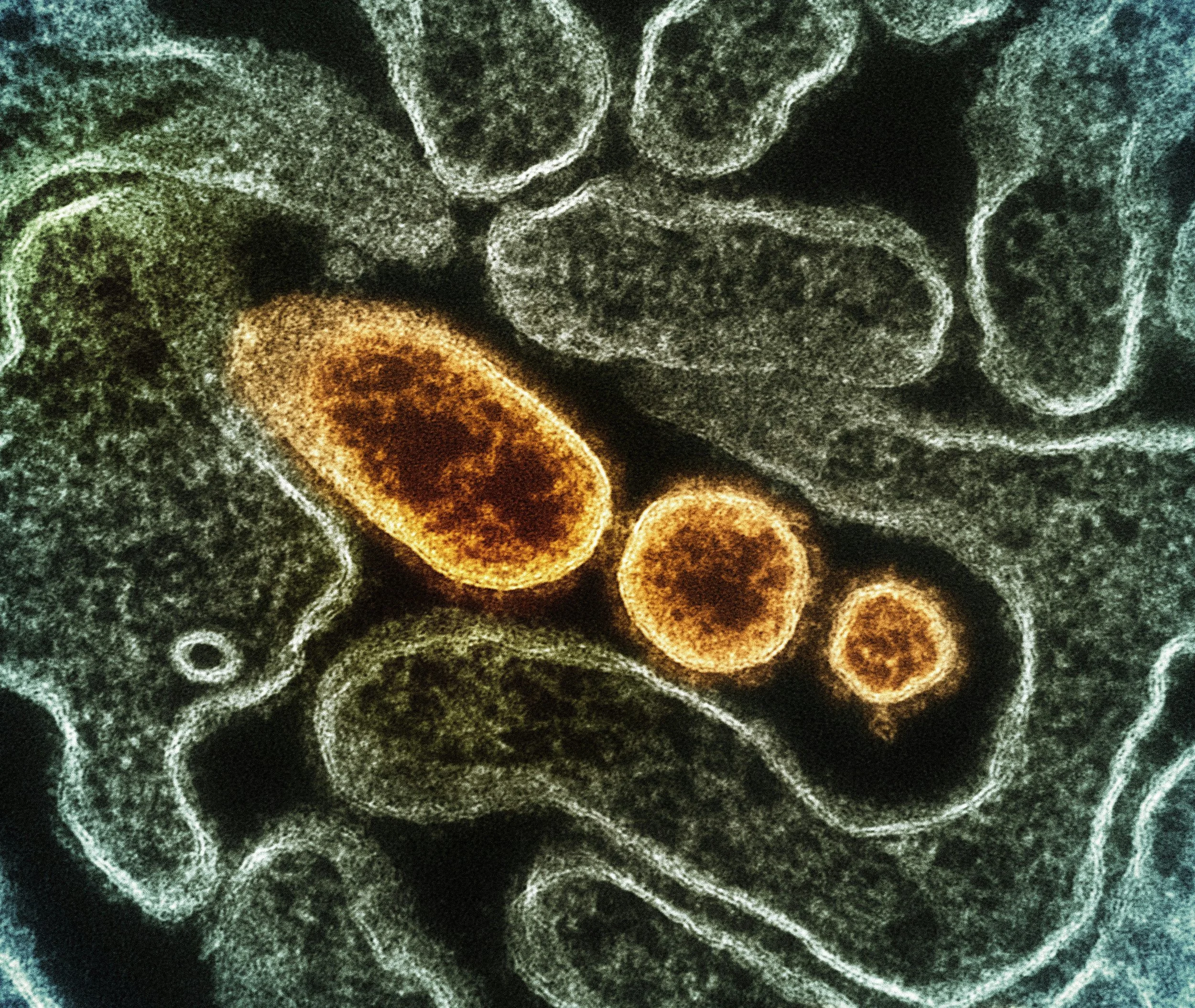 Modeling how viruses bind to cells