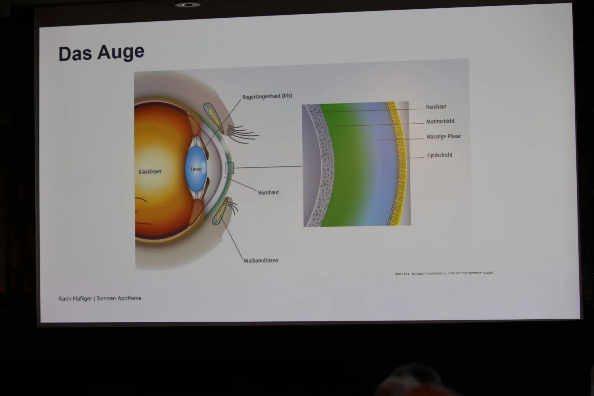 aufbau-auge-besser-sehen-besser-leben-kae-2026.JPG
