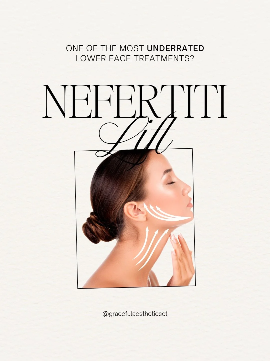 Not enough people know about the Nefertiti Lift&hellip; let&rsquo;s change that.

This treatment uses strategically placed tox along the jawline and neck to relax the muscles that naturally start pulling the lower face downward over time.

The result