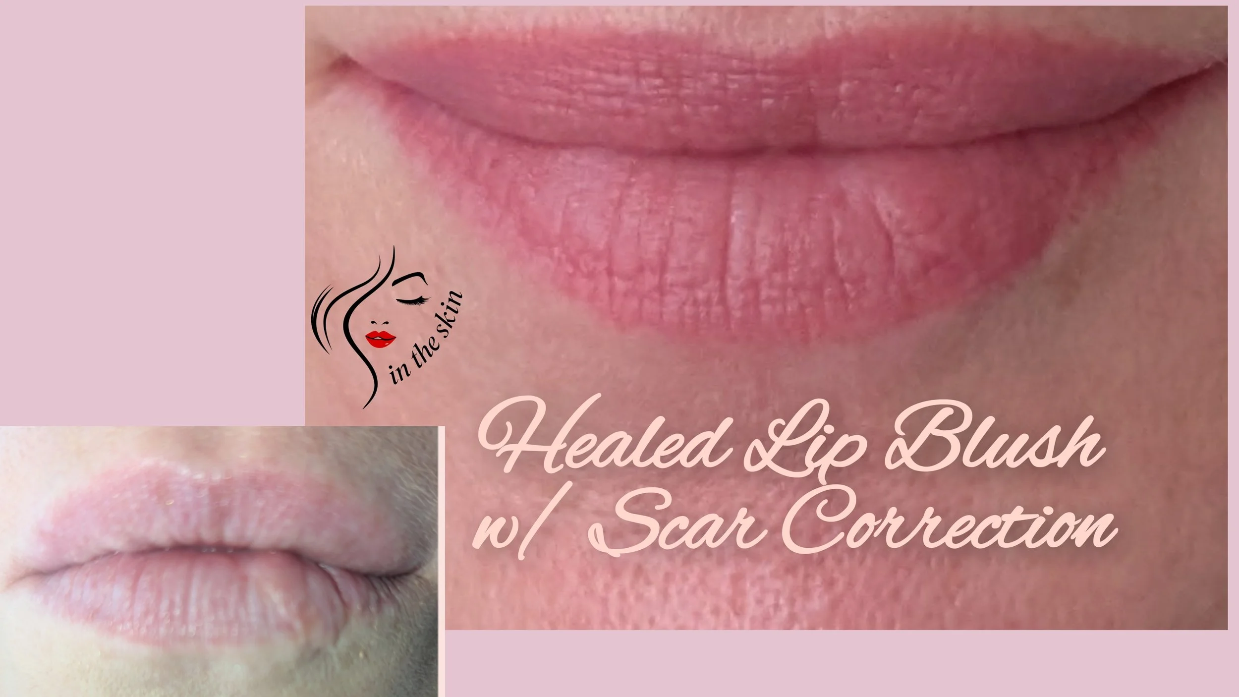 Beautiful Lip Blush Healed Results that boasts a scar correction. Before picture shows pale lips, faded borders & a scar on the bottom that distorts the shape. After shows the same lips with a pop of color, definition and scar is not noticeable