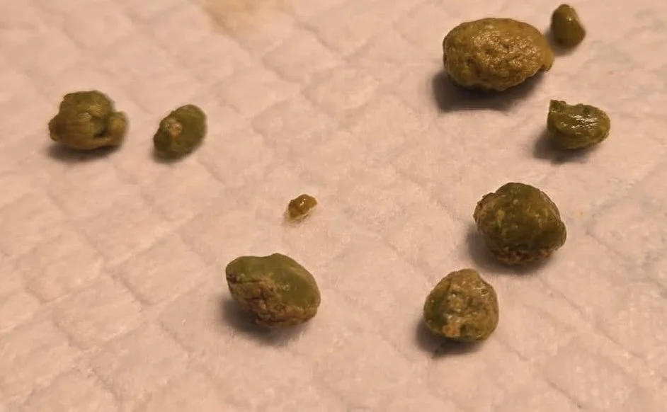 Gallbladder Flush