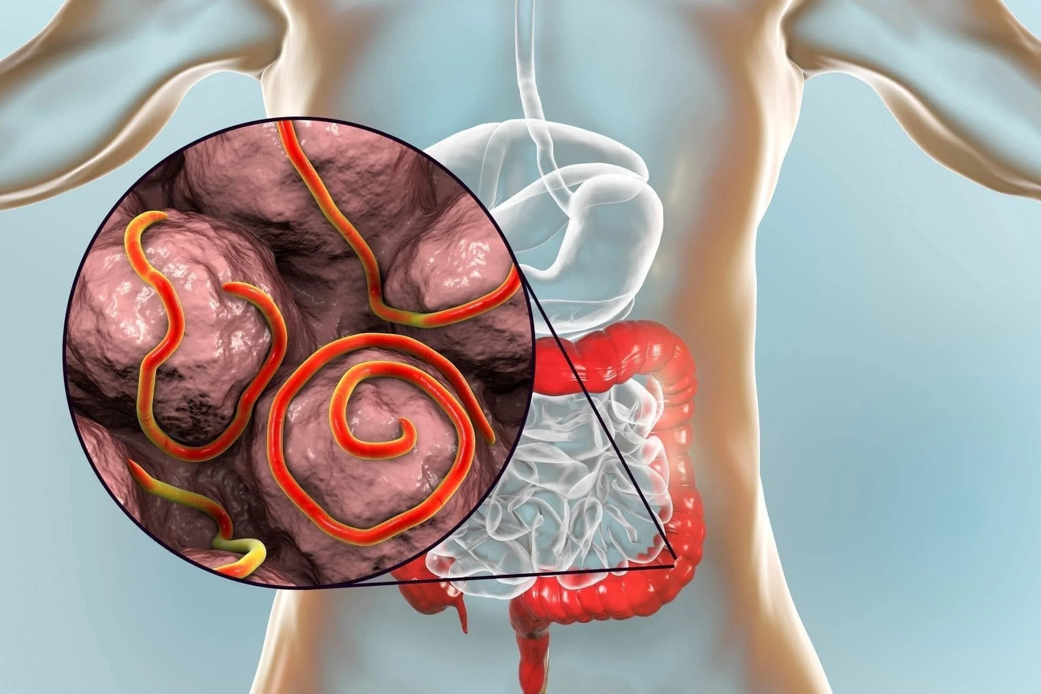 Are You Ready For a Parasite Detox?
