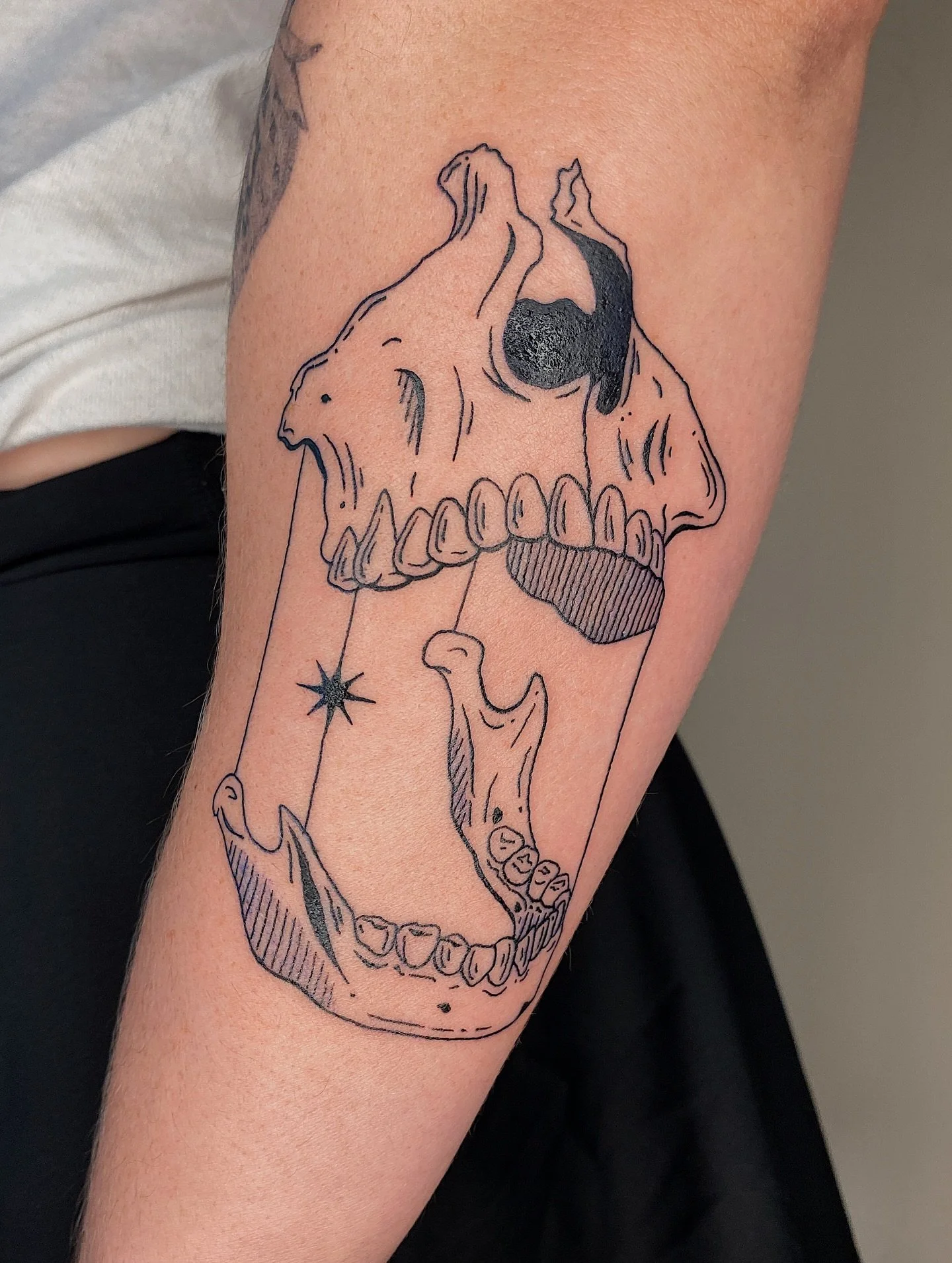 Jawbone from my flash and a healed tummy tat for Chelsea! Thank you!