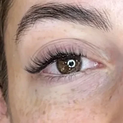 Close-up of a person's eye with an eyebrow and eyelashes visible, freckled skin around the eye.