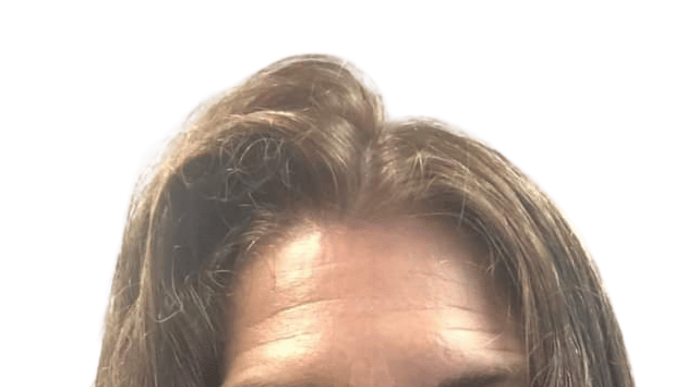 Résultat de volume naturel après une coupe énergétique capillaire : une chevelure densifiée grâce à la stimulation du cuir chevelu.