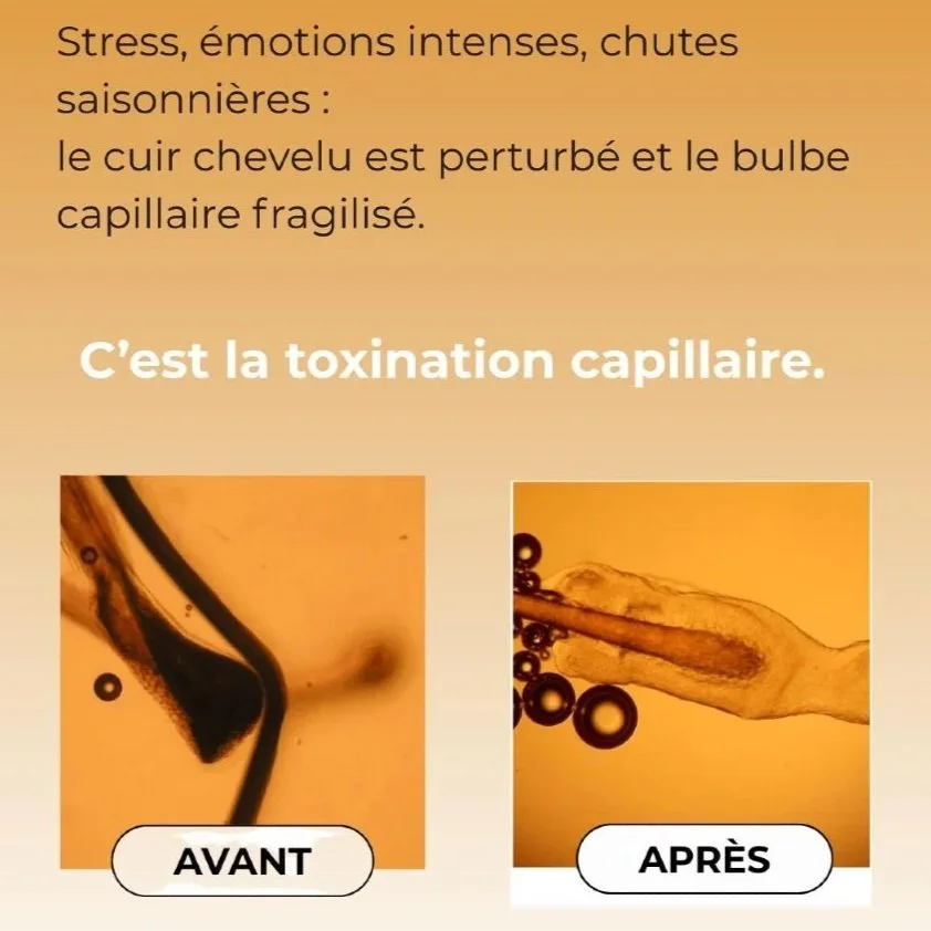 chute de cheveux, stress, émotions, saison/ Beauce Québec