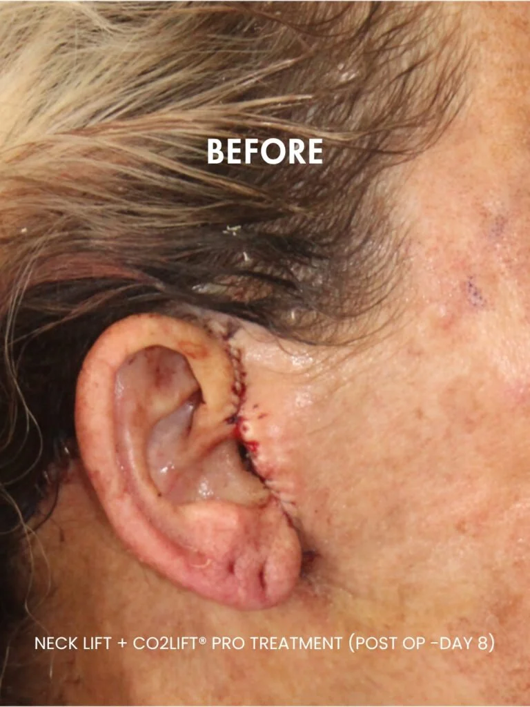 Before-3-768x1024.jpg