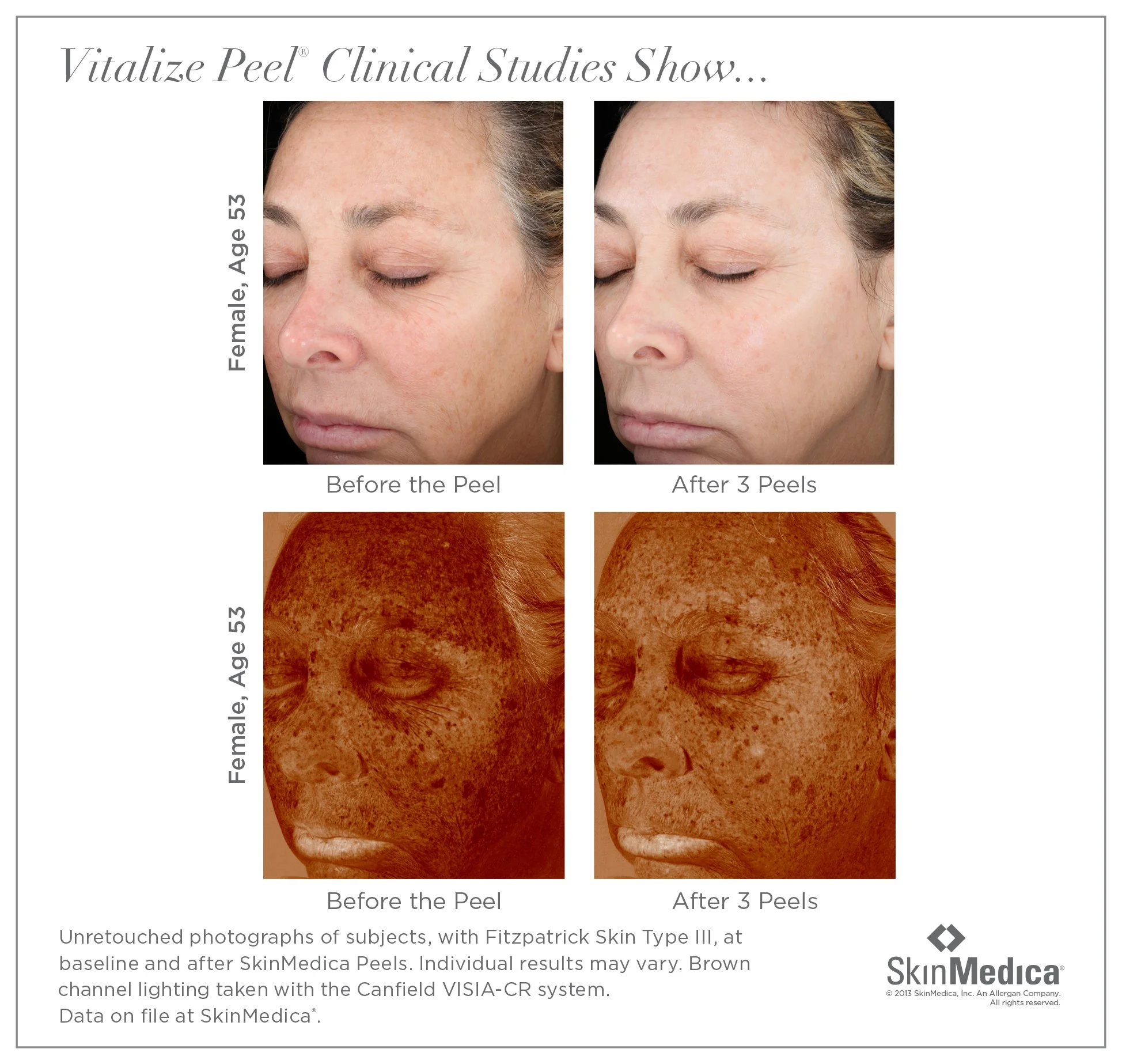VitalizePeel_ClinicalStudies_1.jpg