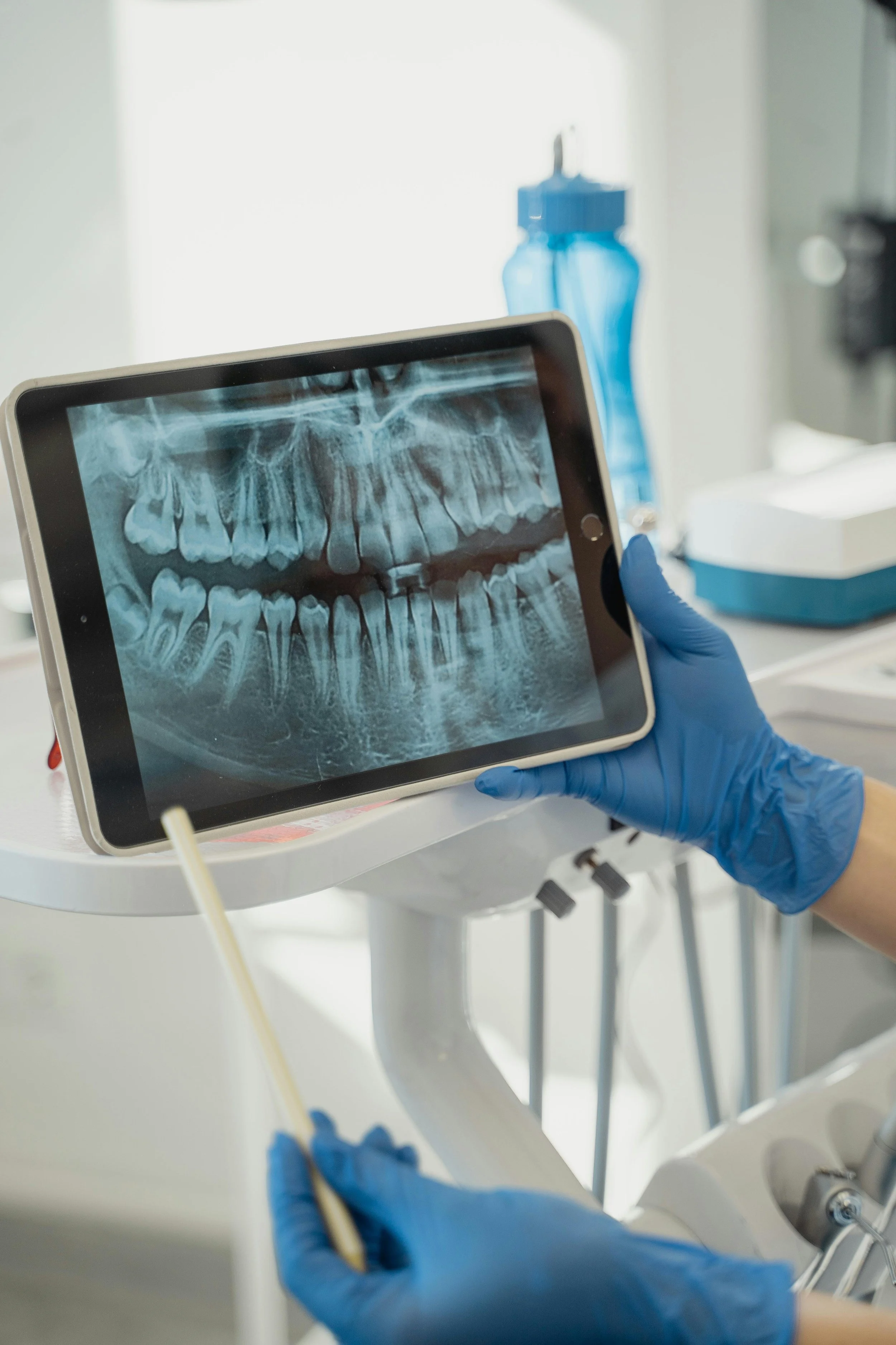 Dental X-Rays Safety and How Often Should They be Done