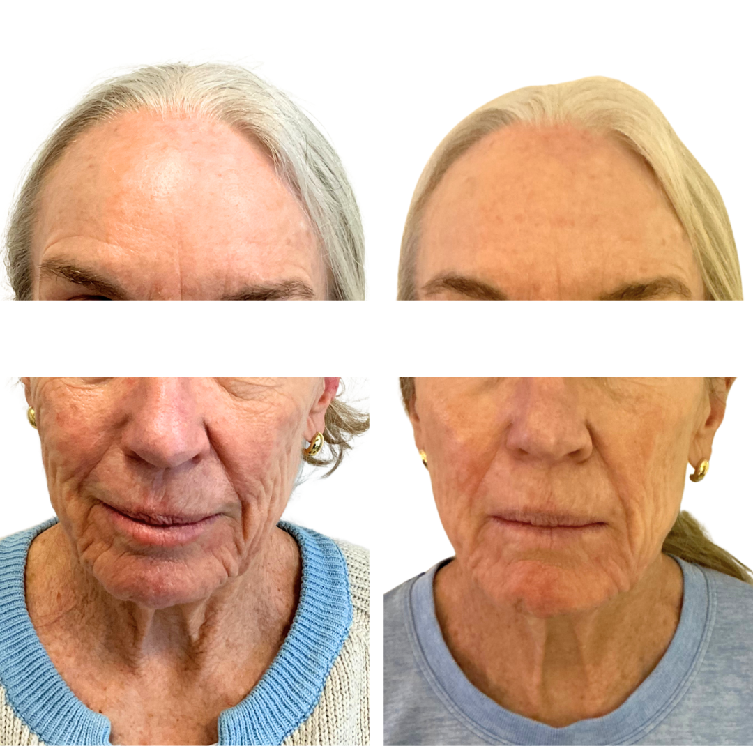 Imagine BA Full Face-4.PNG