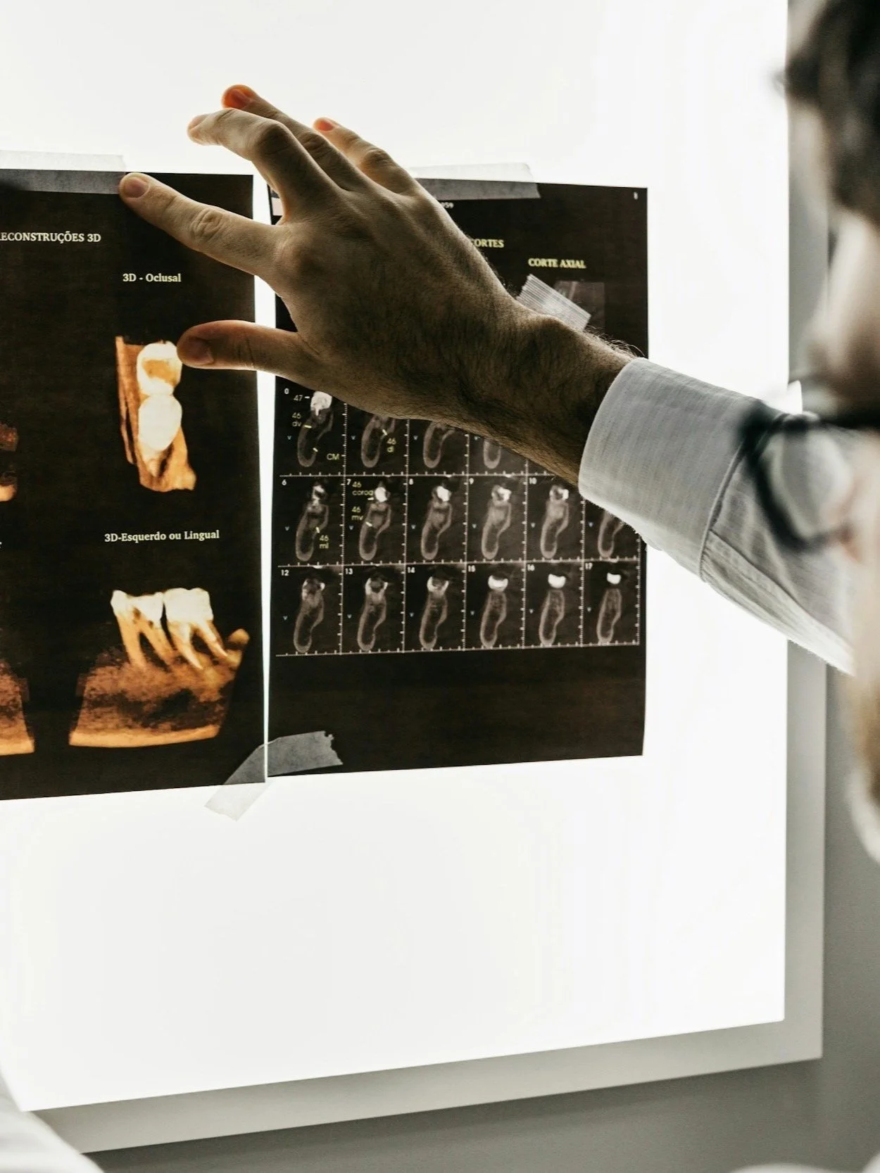 A dentist viewing tooth x-rays
