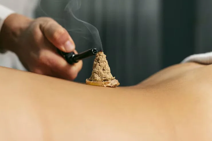 Infrared, Heat, and Moxibustion Therapy