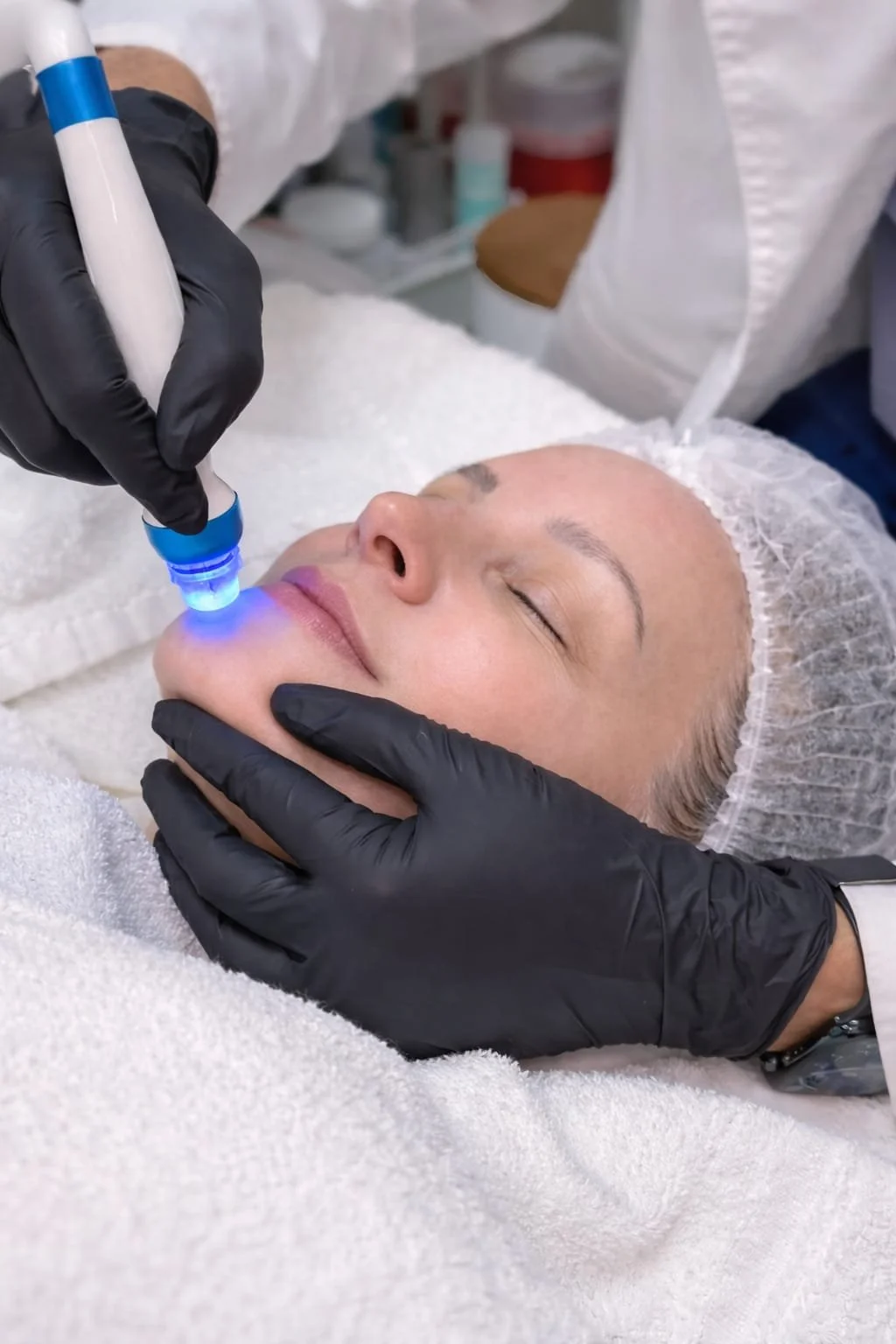 HydraFacial treatment for refined pores at Enova MedSpa in Pinole CA