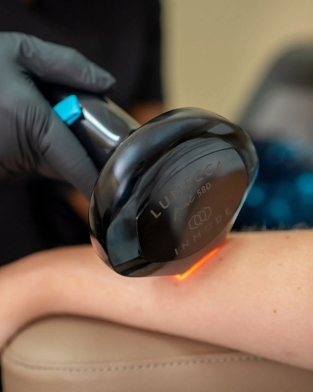 Lumecca IPL in Bay Area San Francisco