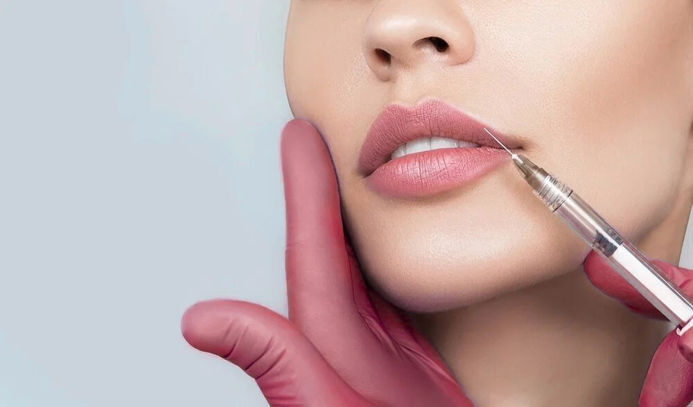 natural looking lip filler results at Enova MedSpa