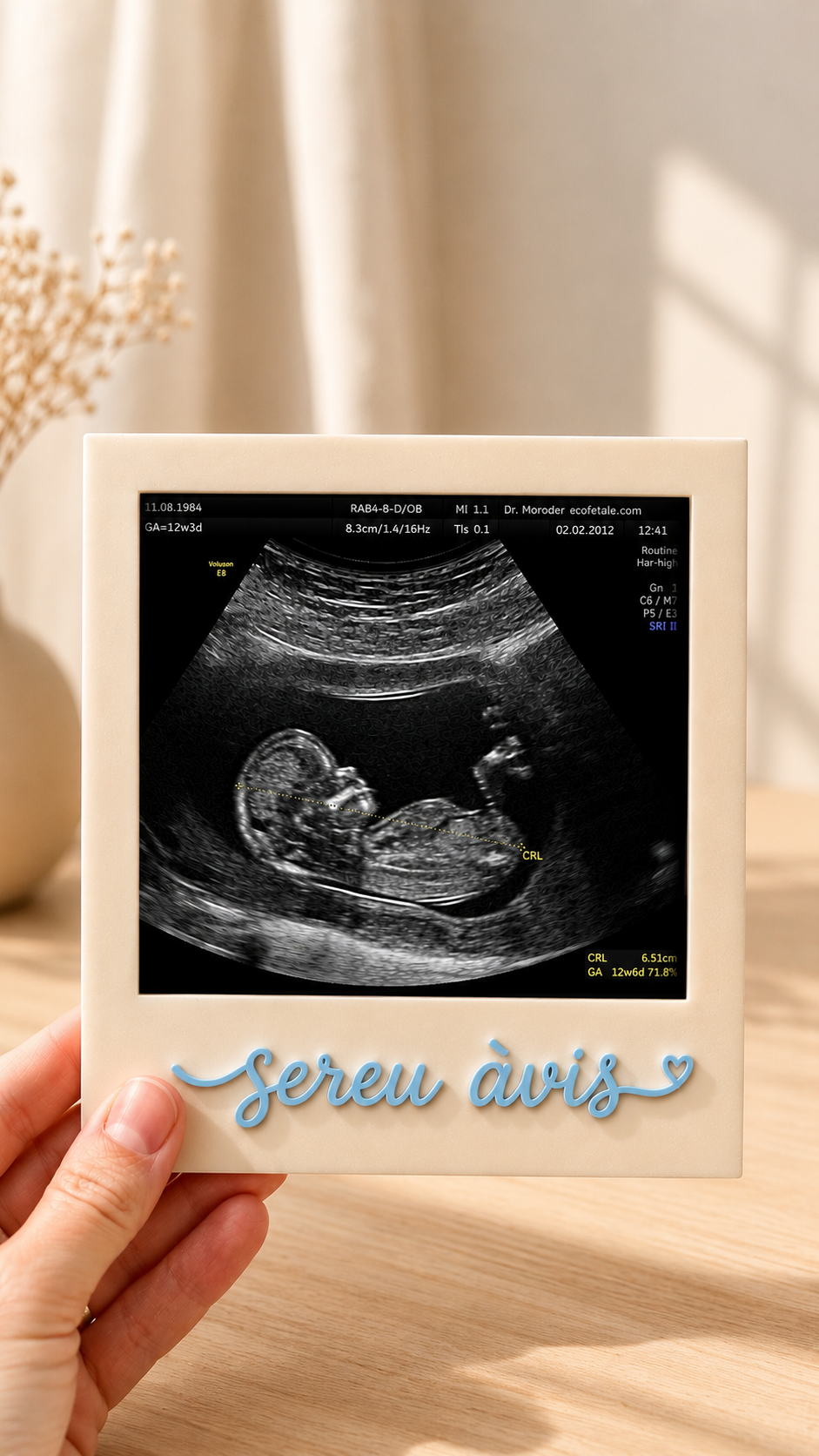 sereu avis.PNG