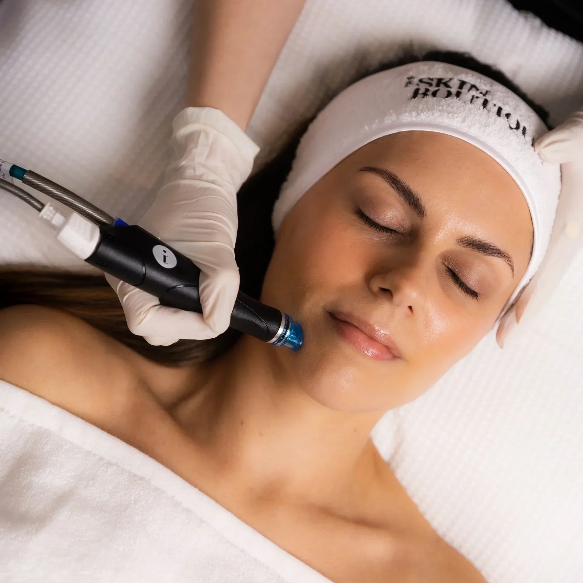 Medical-grade HydraFacial for deep pore cleansing and hydration Calgary.