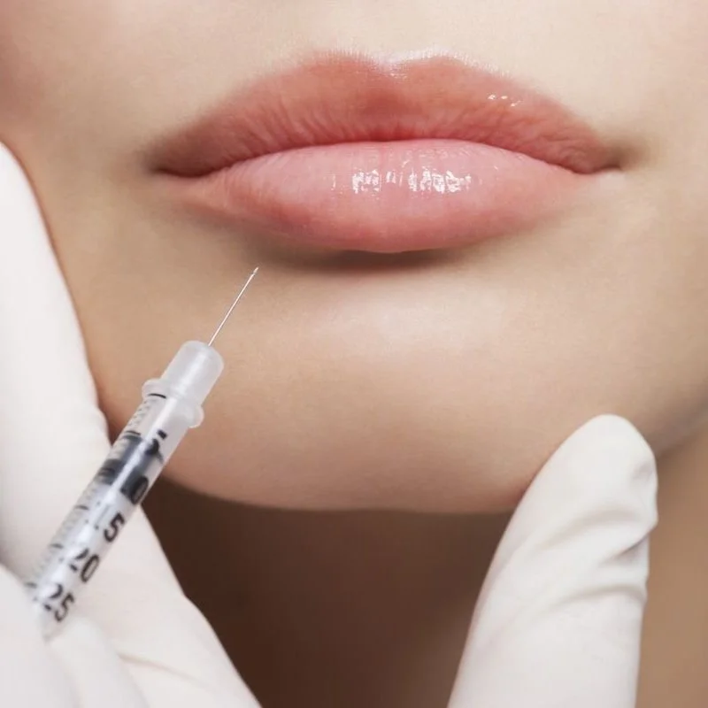 Natural Botox and dermal filler injections by Nurse Elaine Wilson Calgary