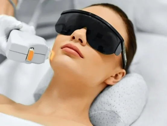 A woman lying down with a laser skin treatment device near her face, wearing protective goggles.