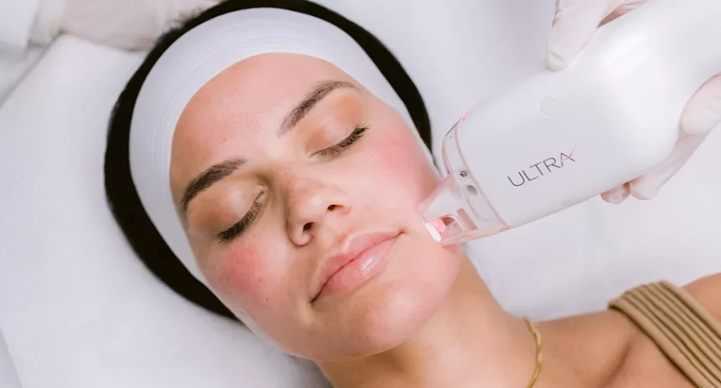 Lutronic Ultra laser for pigment correction and skin brightening.