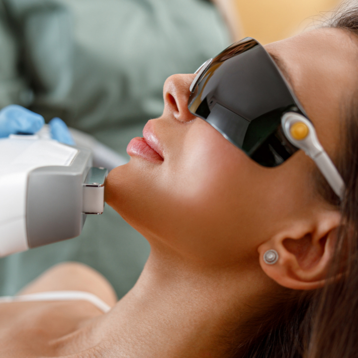 eCO2 laser resurfacing for deep wrinkles and acne scars Calgary