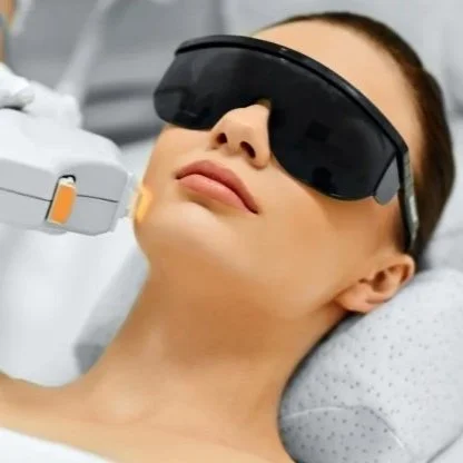 Laser Genesis treatment for skin texture and redness at Calgary clinic