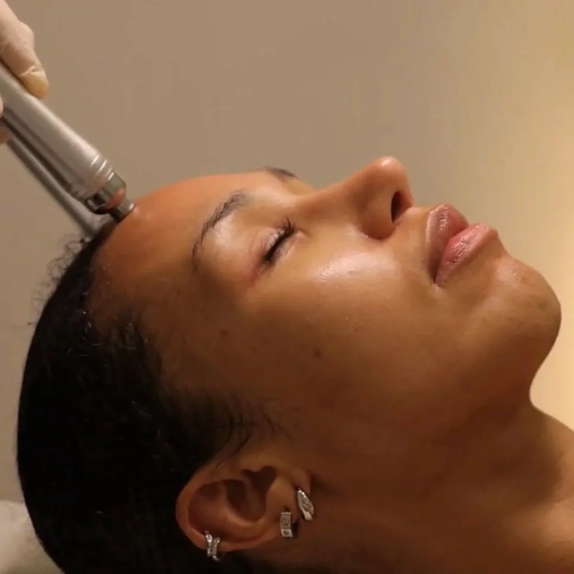 Practitioner using a facial treatment device on a client’s forehead