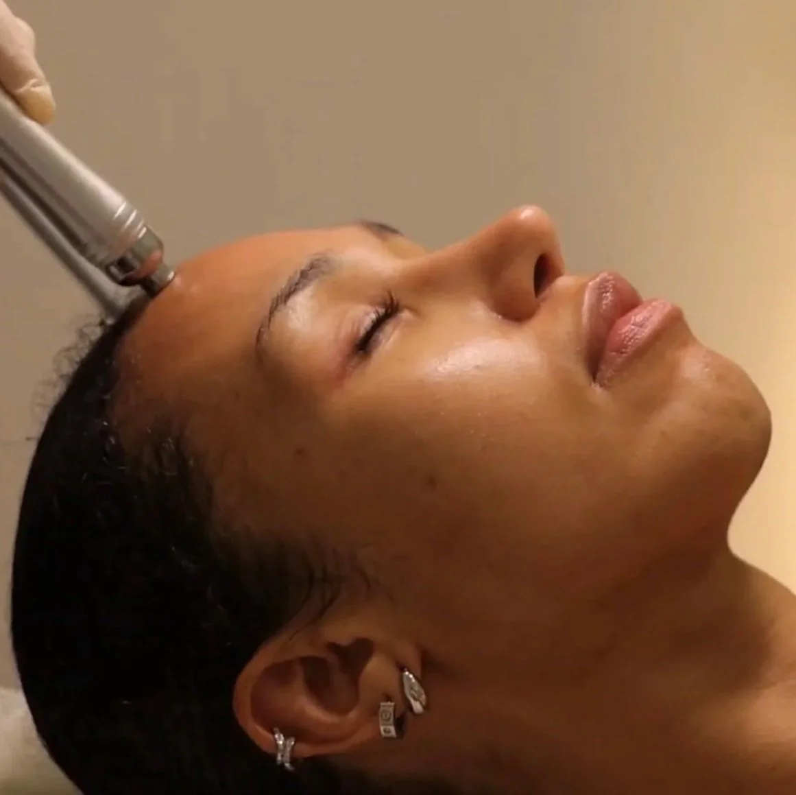 Practitioner using a facial treatment device on a client’s forehead